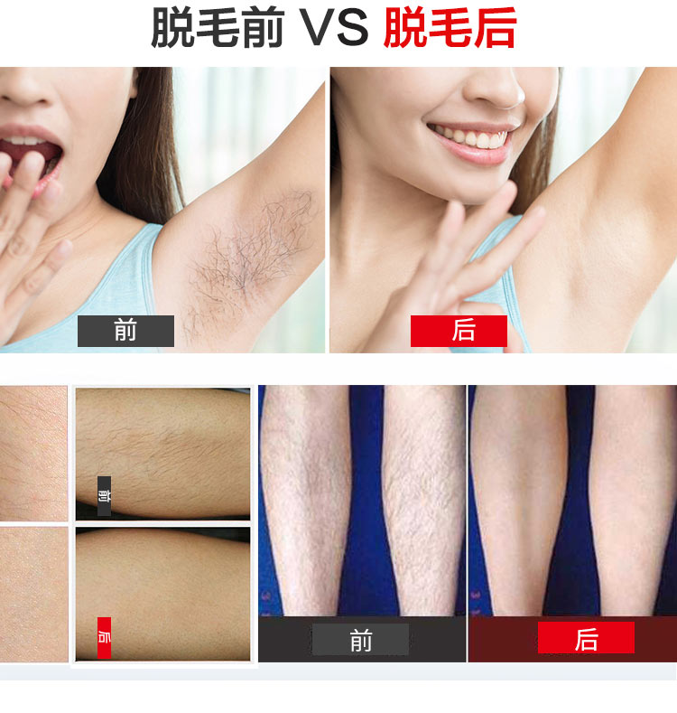 女士禮品脫毛儀 G1便攜小巧精致 光子脫毛儀器 家用禮品OEM貼牌方案 生產廠家(圖9)