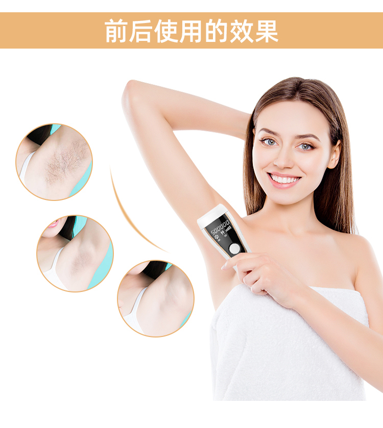 2020熱銷 M3全新家用激光ipl脫毛儀 無痛冰點脫毛方案/OEM 源頭廠家(圖6)