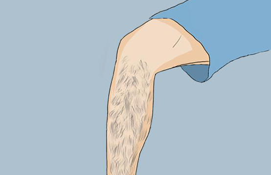 盤(pán)點(diǎn)那些錯(cuò)誤的脫毛方法 ，你中招了沒(méi)