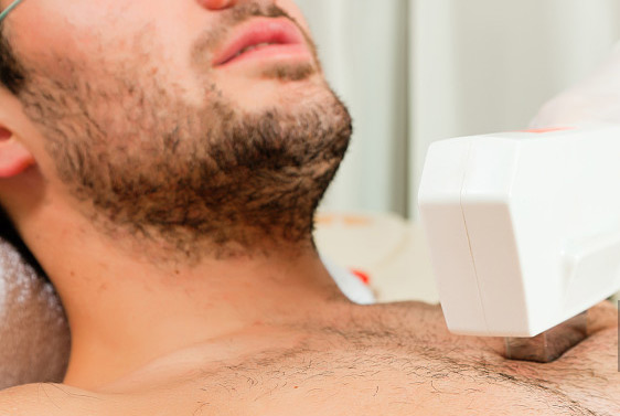 在家脫毛:不僅女性要脫毛,男性也逃不掉(圖1) 在家脫毛:不僅女性要脫毛,男性也逃不掉(圖1)