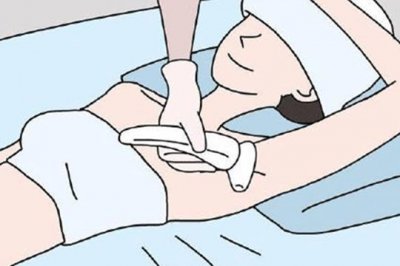 使用家用光子脫毛儀，你需要知道這幾點