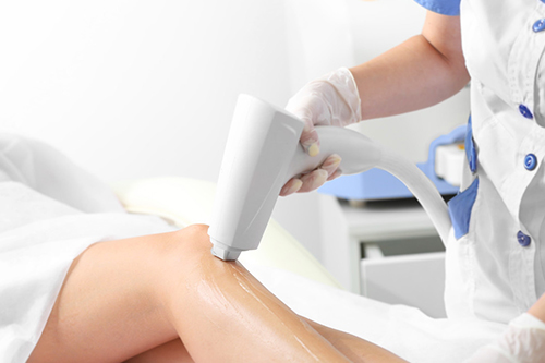 激光脫毛儀 激光脫毛儀