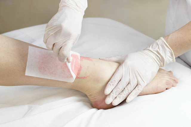 盤點那些年我們用過的脫毛方法——諾鉑創新(圖2) 盤點那些年我們用過的脫毛方法——諾鉑創新(圖2)