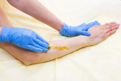 脫毛那些事之光動力脫毛