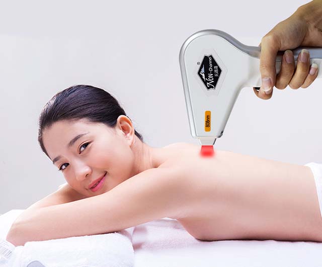 家用光子脫毛儀種草指南(圖2)