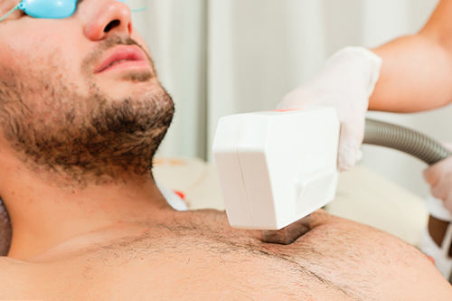 脫毛儀對皮膚有害嗎？(圖2)