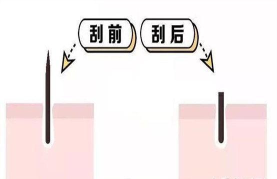 刮毛后毛發(fā)越變越硬是怎么回事