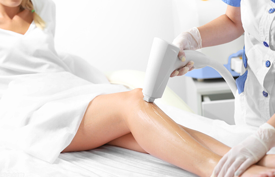 脫毛儀選購攻略(圖1)