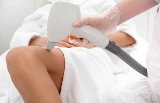 激光脫毛，女生腿毛長(zhǎng)是一種怎樣的體驗(yàn)？(圖1)