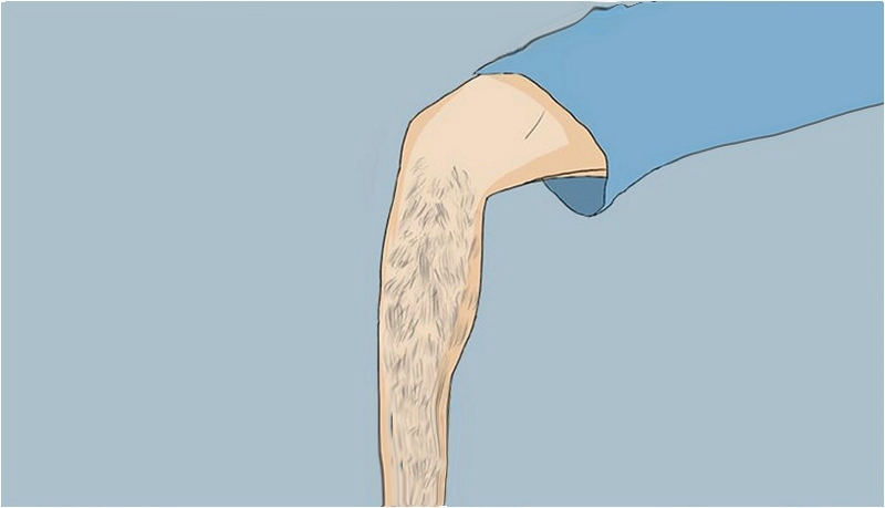 家用脫毛儀用之前可以拔毛嘛(圖1) 家用脫毛儀用之前可以拔毛嘛(圖1)